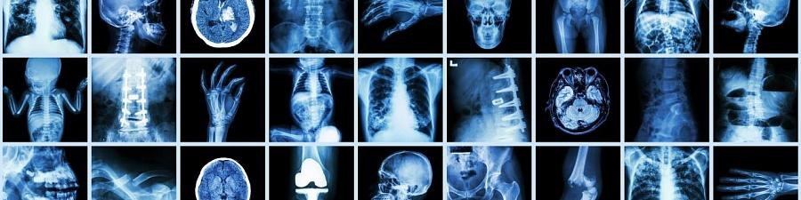 Ценность стандартов МЭК возрастает в Международный день радиологии